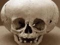 SKULLS FROM PERU - A Pic is Worth Ten Thousand Words. . .